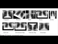 Data Augmentation on a Single Image Part 1 of 3