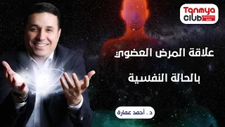علاقة المرض العضوي بالحالة النفسية د أحمد عمارة Ahmed Emara 
