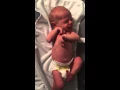 Best Moro Reflex Ever
