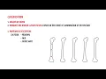 Download Lagu Femoral Shaft Fracture - mechanism and types