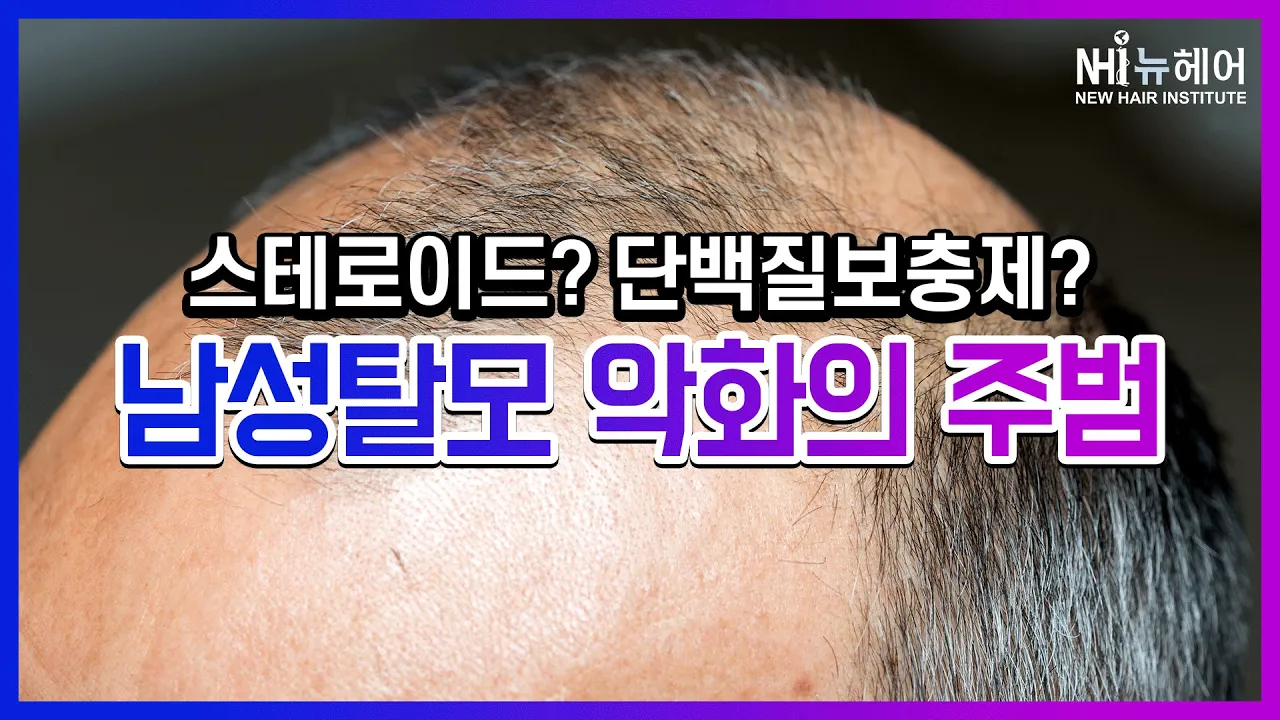 유전성 남성탈모 악화의 주범 - 뉴헤어 I 탈모치료