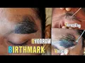 EYEBROWS THREADING BIRTHMARK Giant Eyebrows