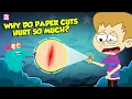 Download Lagu Why Do Paper Cuts Hurt So Much? | How Does Your Brain Respond to Pain? | The Dr. Binocs Show