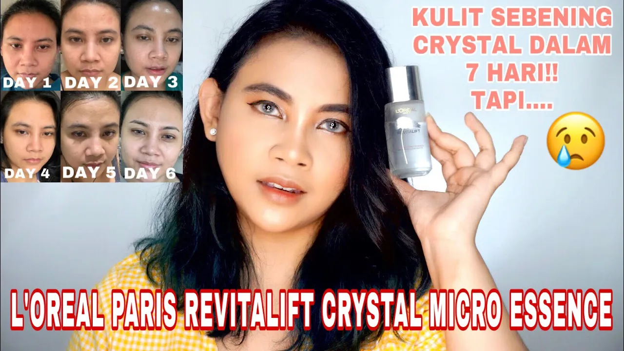 30 hari Pakai Loreal Revitalift 1,5%Hyaluronic Acid Serum (kulit berjerawat, berminyak dan sensitif). 