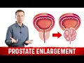 The Real Cause of Prostate Enlargement - Dr Berg