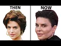Lisa Rinna s NEW FACE Plastic Surgery Analysis