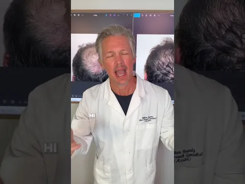 Still Losing Hair After Your Transplant? Here Is Why