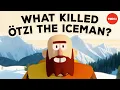 A 5 300-year-old murder mystery - Albert Zink