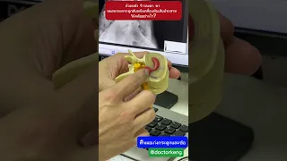  ทำไมถึงรู้สึกเจ็บและชาที่ขา ขณะยกขึ้น 