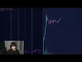 XWEL stock Why I m staying away