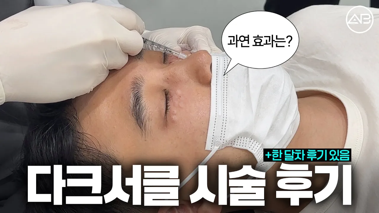 다크서클 때문에 고민이신 분 집중!