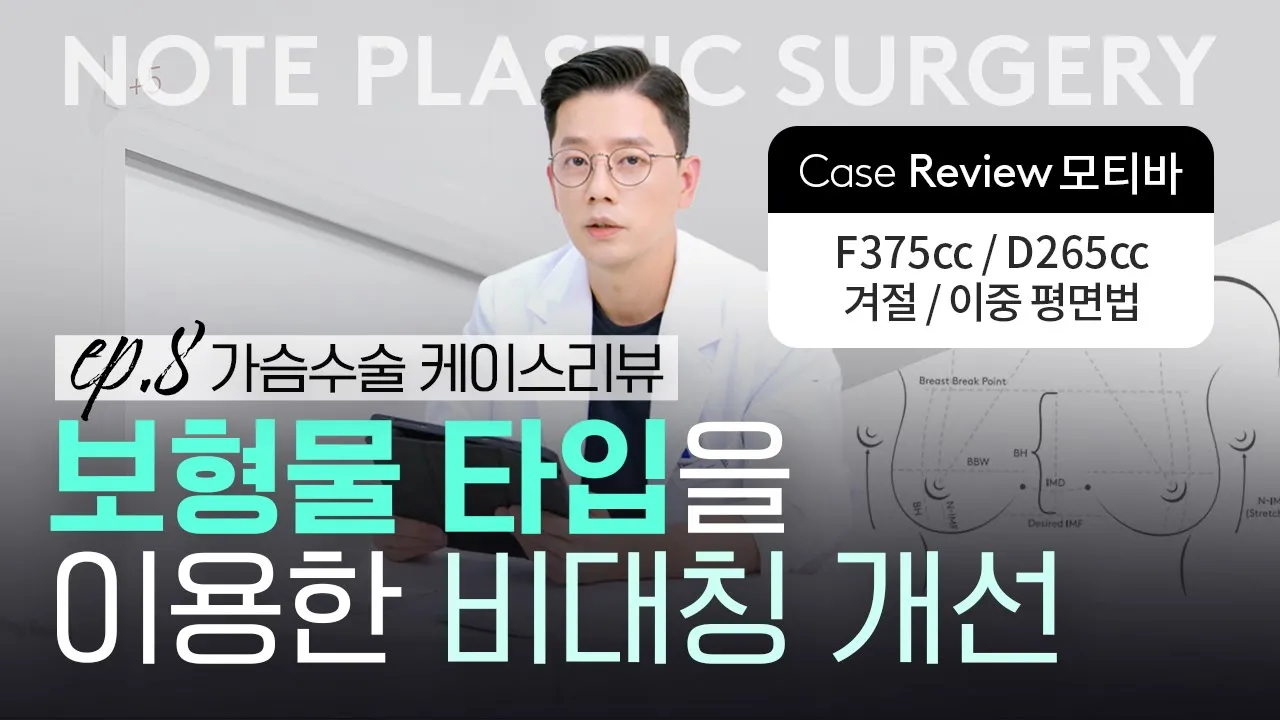 [가슴리뷰] 가슴방 비대칭 l 흉곽 비대칭 l 볼륨 비대칭 l 모티바