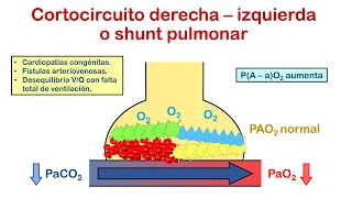 INSUFICIENCIA RESPIRATORIA - Parte 1 (Concepto, Clasificación y Fisiopatología) 🤓👍🏻
