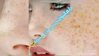 حالات حمو بيكا خليج العطارين تعبان بموت ياعيني وانتي ولاة حسه 