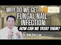 Why Do We Get Fungal Nail Infections Tinea How Can We Treat Them