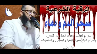سحر الدم سحر الدم المرشوش بالنجاسات و دم الحيظ و النفاس 