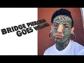 Bridge Piercing Goes Wrong