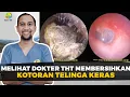 Melihat Dokter Tht Membersihkan Kotoran Telinga Keras | Dokter Tht