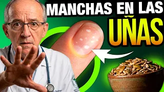 💅 Si Tus UÑAS Tienen "MANCHAS BLANCAS" O Puntos, Tu Cuerpo Pide Esto - Oswaldo Restrepo RSC
