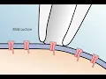 The Patch Clamp Method