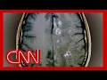 Dr Gupta explains what could have led to RFK Jr having a worm in his brain