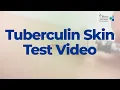 Tuberculin Skin Test - 2022