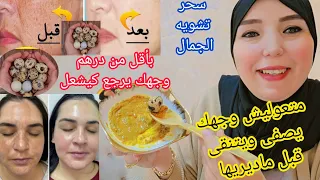 بلاما تعيي راسك ماخليتي مادرتي لوجهك بدون نتيجة😔قسما بالله غادي يصفى ويتنقى ويولي عندك القبول فوجهك