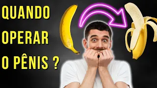 CIRURGIA DE FIMOSE: QUANDO VOCÊ DEVE OPERAR O PENIS?