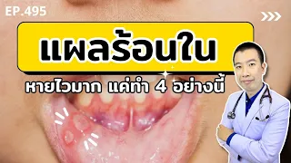 ควรทำอย่างไรเมื่อมีแผลร้อนในในปากเพื่อให้หายเร็วขึ้น