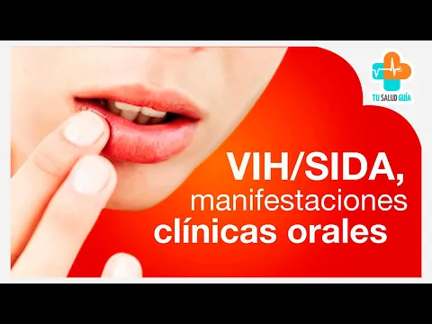 Download MP3 VIH/SIDA Manifestaciones clínicas bucales | Tu Salud Guía