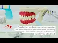 Affordable Direct-To-Consumer Options For Implant-Supported Dentures 2025 Price List