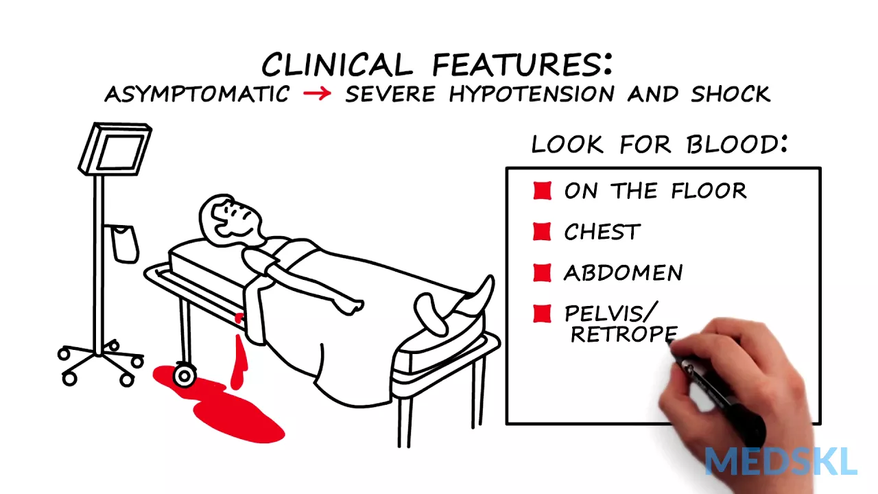 Vascular Surgery – Vascular Injury: By Adam Power M.D. and Yiting Hao R.N.