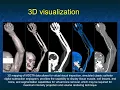 State of the CTA Assessment of Upper Extremity Trauma Pearls Pitfalls Study Design Optimization