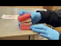 Triangle elastics