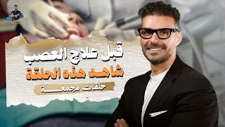 حشو العصب  وغسول الفم: حقائق لا يخبرك بها طبيب الأسنان | حلقات مجمعة