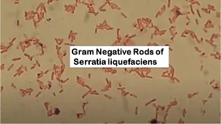 Serratia liquefaciens in Gram Staining of Culture