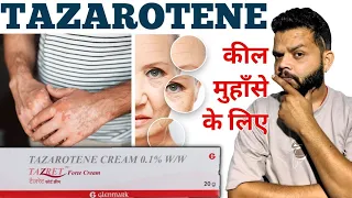 Tazarotene Gel | Tazarotene cream 0.1 | Tazarotene gel 0.05 review uses, side effects