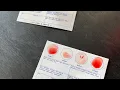 Blood Type Test