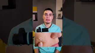 هصدمك 7 مرات في 30 ثانية ج17 