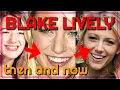 Blake Lively then and now before after rhinoplasty plastic surgery transformation teeth fixed