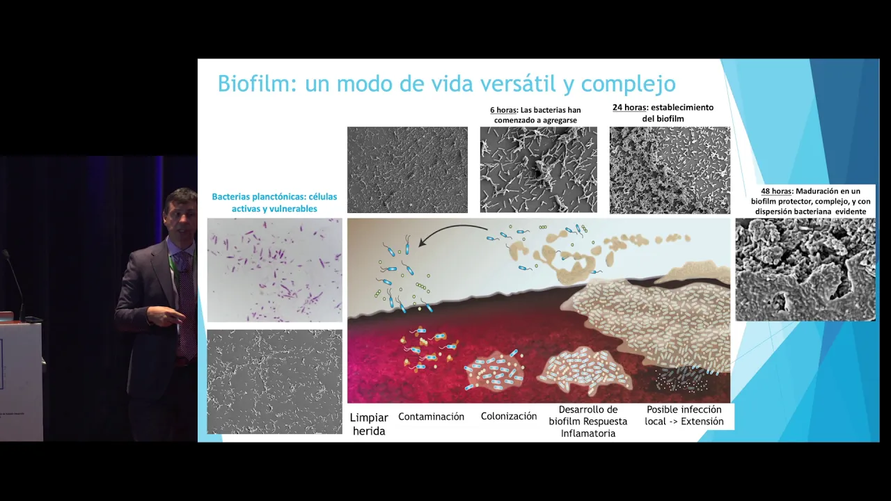 ¿QUÉ SABEMOS Y QUÉ NO SABEMOS SOBRE EL BIOFILM?