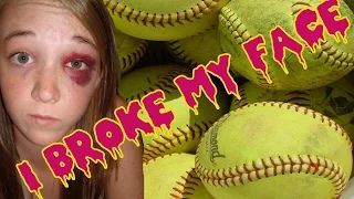 PLASTIC SURGERY I BROKE MY FACE Meghan McCarthy