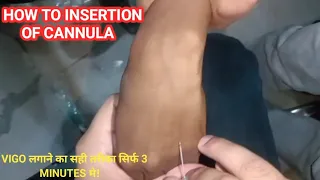 IV Cannula Insertion Technique in Hindi | Cannula Kaise Lagaye Step by Step | IV Cannulation | vigo