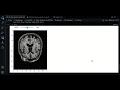 0 1 - SimpleITK review