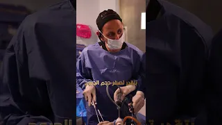 التكميم الدقيق يعني تعافي سريع وحياة جديدة بدون سمنة مع د  أحمد المصري دندنها