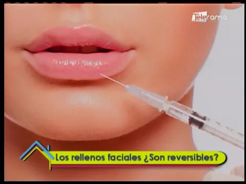 Los rellenos faciales ¿Son reversibles?