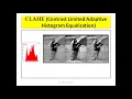 CLAHE Contrast Limited Adaptive Histogram Equalization Comparison With Histogram Equalization