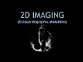 2D IMAGING Image optimisation Echocardiogram