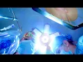 ASMR Hospital POV Surgery Appendectomy Going Under Anesthesia Procedure Post-Op Recovery