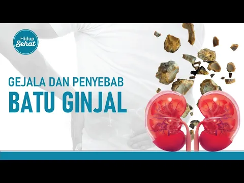 Gejala dan Penyebab Batu Ginjal yang Jarang Disadari